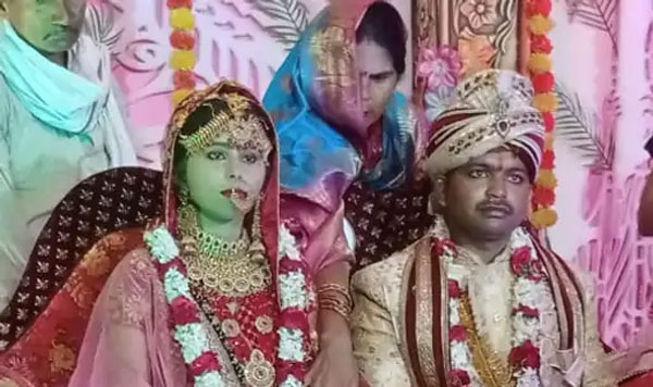 प्रतापगढ़ में पति के पेट में चीरा देख ससुराल से मायके लौटी दुल्हन, वापस आने के लिए रखी शर्त...